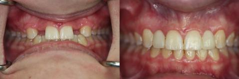 A happy customer of Malo Dental Prosthodontics