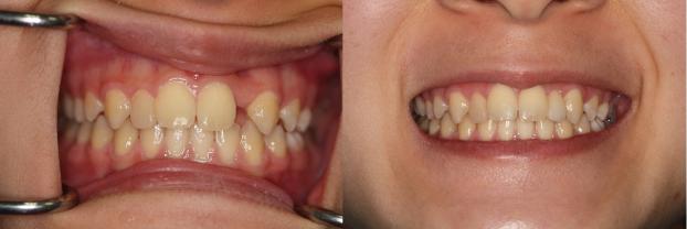 A happy customer of Malo Dental Prosthodontics