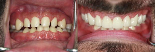 A happy customer of Malo Dental Prosthodontics