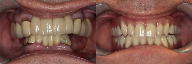 A happy customer of Malo Dental Prosthodontics
