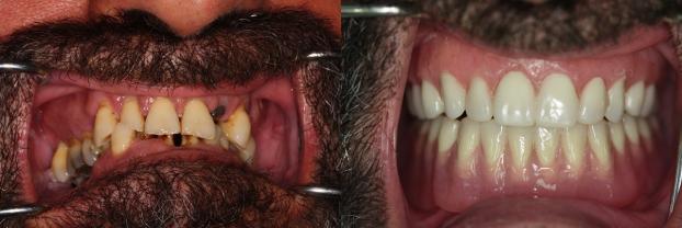 A happy customer of Malo Dental Prosthodontics